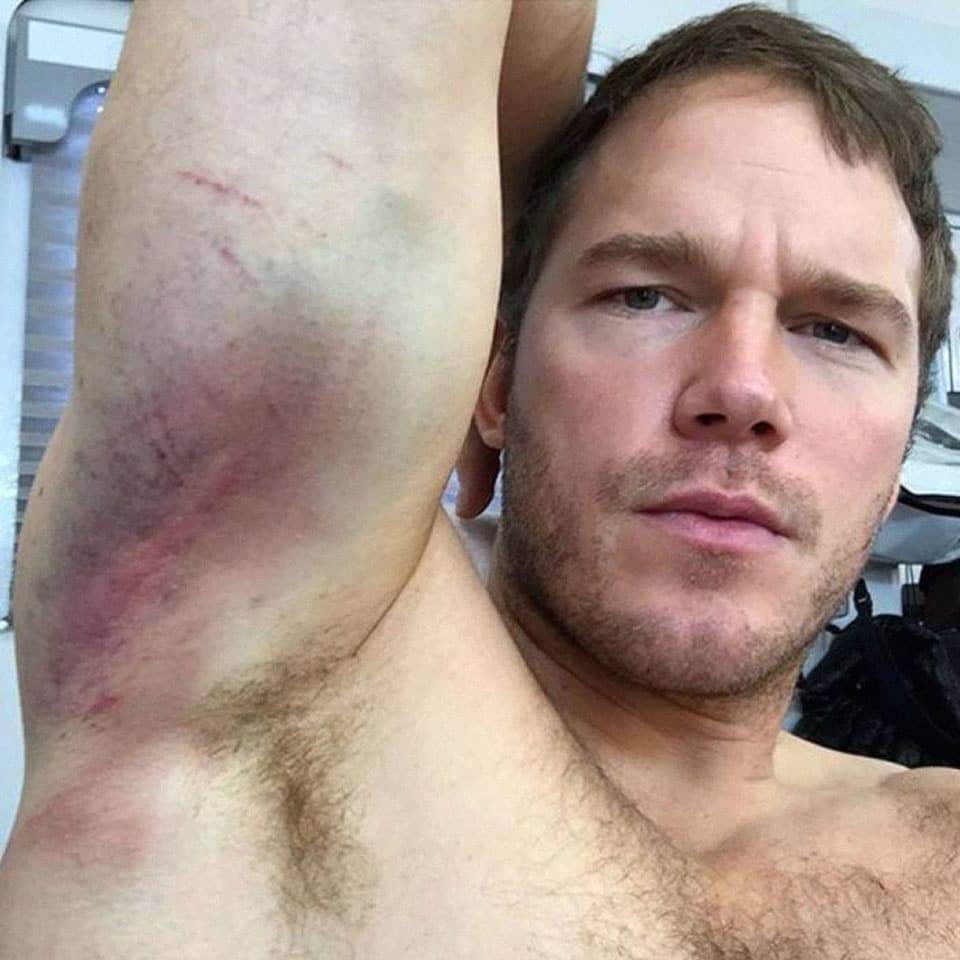 Chris Pratt | Celeb Masta 18